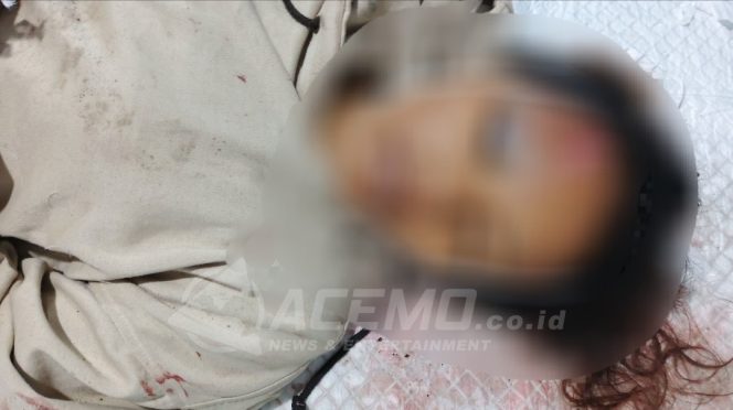 
 Kecelakaan Maut di Anday: Satu Korban tewas,Satu Luka, Dua Rekan Korban Melarikan Diri